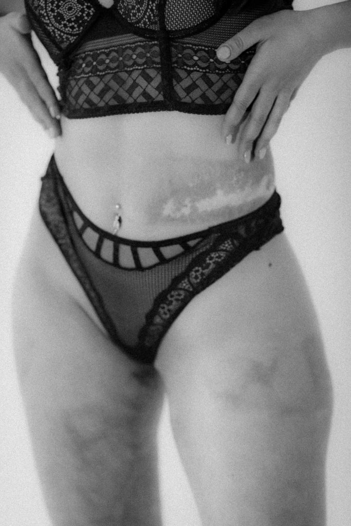 A striking black and white fashion portrait highlighting body positivity and elegance in lingerie. Portrait de mode en noir et blanc mettant en valeur la positivité corporelle et l'élégance en lingerie.